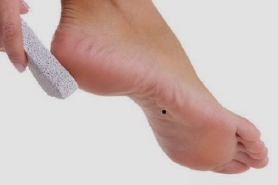 Nốt ruồi ở chân có ý nghĩa gì?